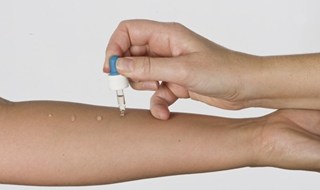 Allergia al nickel, un vaccino in pillole per desensibilizzare il paziente